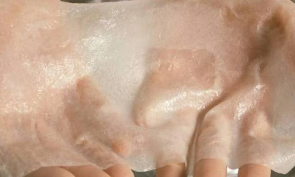 Εργαστήριο υπόσχεται το τέλος της φαλάκρας - Έφτιαξαν τεχνητό δέρμα με τρίχες